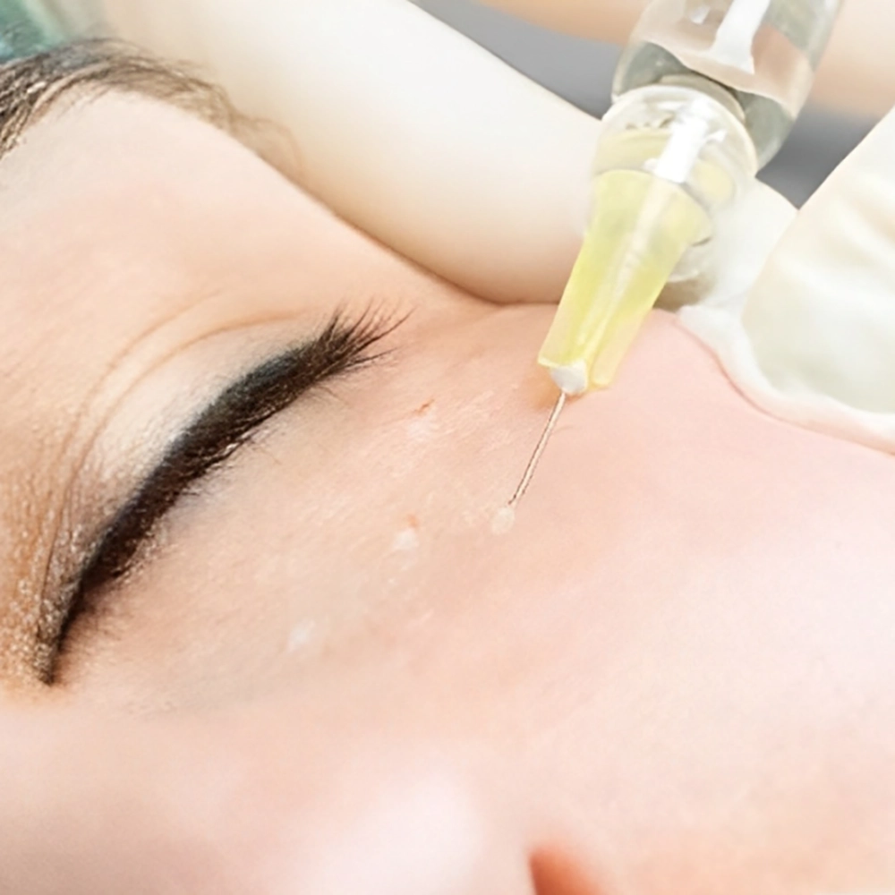 فیلر مناسب برای زیر چشم چیست؟