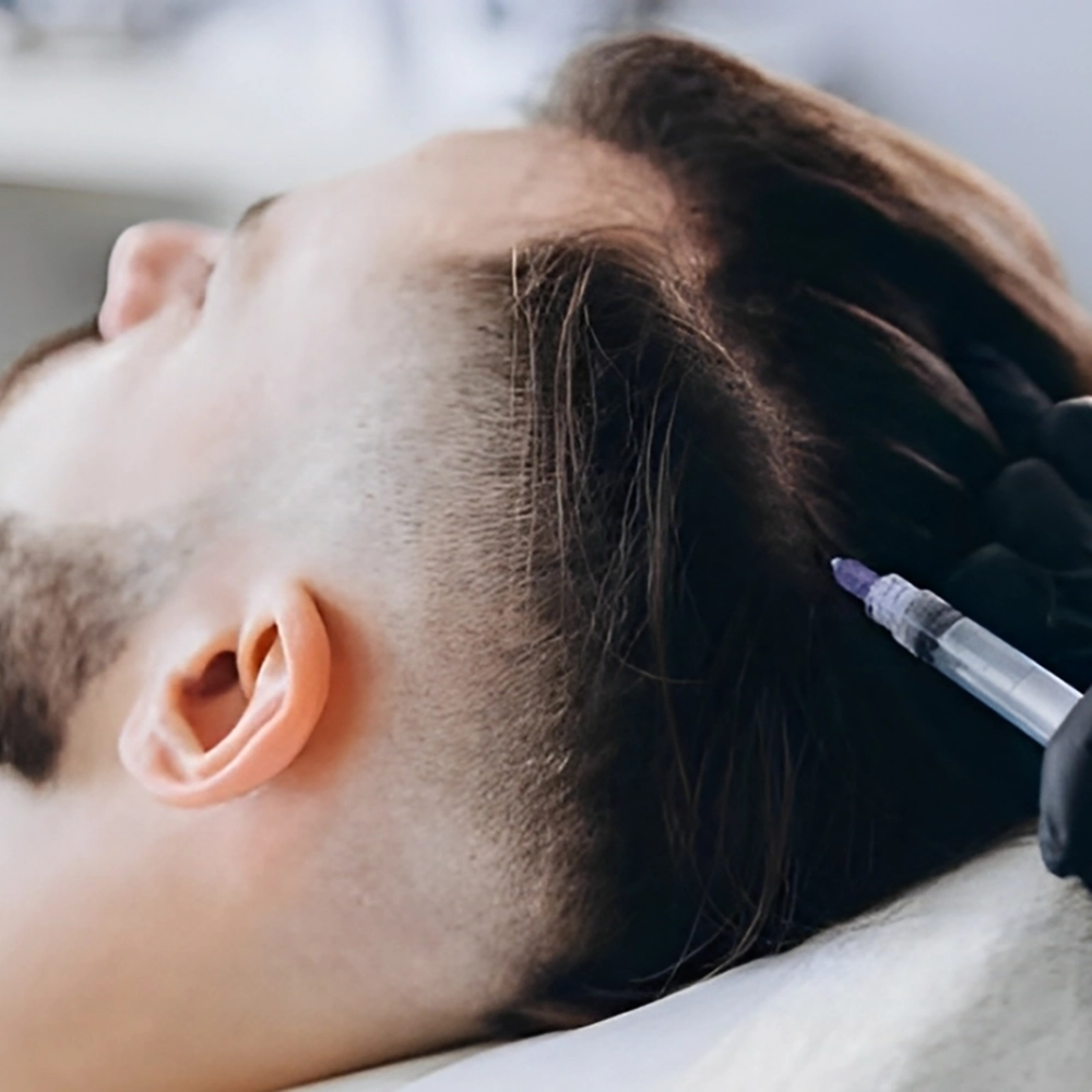 هیر فیلر مو چیست